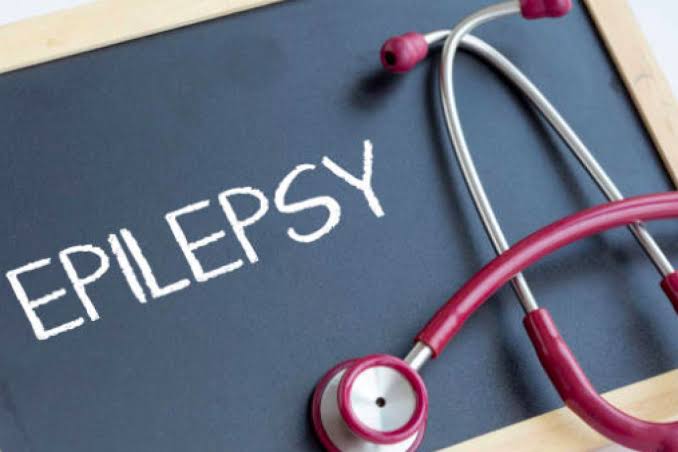 Obat yang Ampuh Atasi Kejang Akibat Epilepsi, Ikuti Resep Dokter Ya 