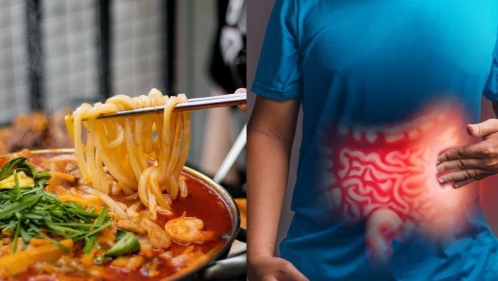 5 Makanan Penyebab Usus Buntu yang Perlu Diketahui, Hindari agar Usus Tetap Sehat!