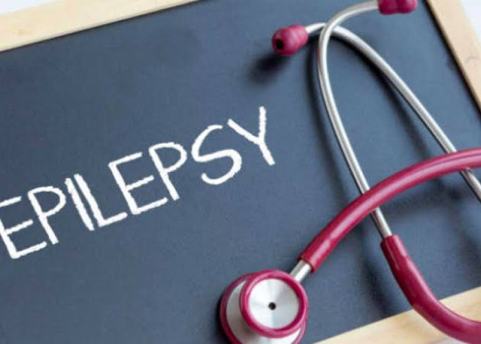 Obat yang Ampuh Atasi Kejang Akibat Epilepsi, Ikuti Resep Dokter Ya 