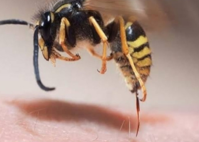 Terkena Sengatan Lebah Jangan Langsung Panik, Simak Pertolongan Pertama Berikut